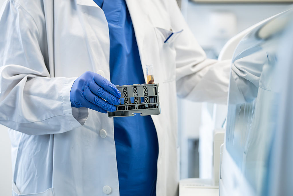 Imagen de un laboratorio médico en Balingen, Baden-Württemberg, Alemania, el 24 de abril de 2025.