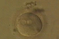stemmcell.jpg