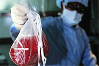 transplantation_03.jpg