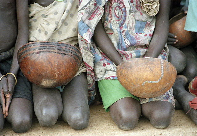Appel à l’aide pour des milliers d’enfants menacés par la famine en Afrique