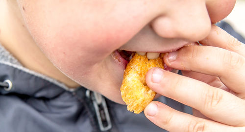 L’obésité explose chez les jeunes
