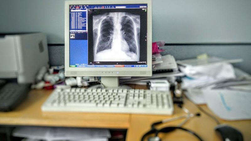 L'accès aux traitements contre le cancer varie grandement en Europe