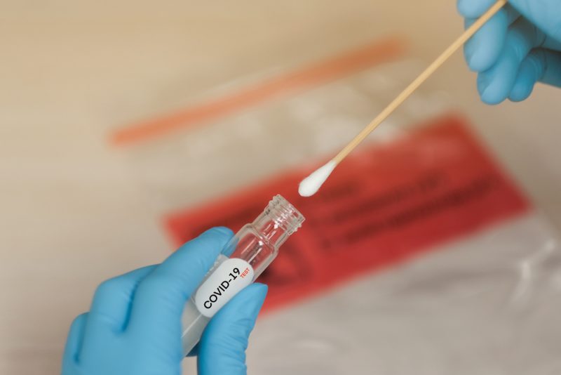 Bientôt des certificats d’immunité au coronavirus ?
