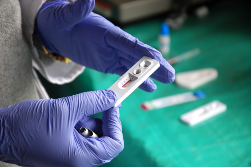 A l'ombre du Covid, le sida avance en Europe de l'Est