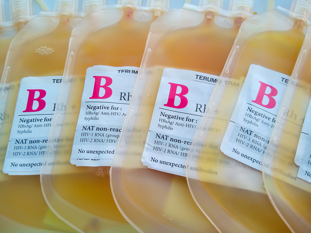 Plasma,In,Blood,Bag