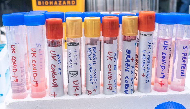 L’EMA encourage les fabricants de vaccins contre la Covid-19 à cibler plusieurs variants