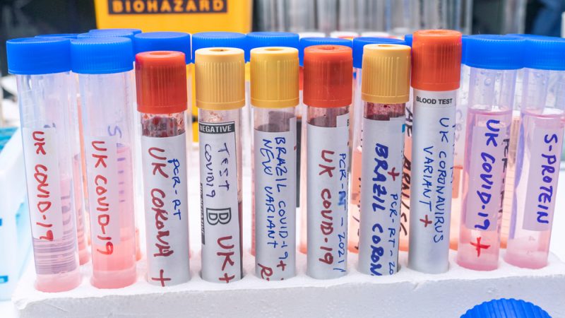 Les autorités sanitaires suédoises mettent en garde contre un hypothétique nouveau variant