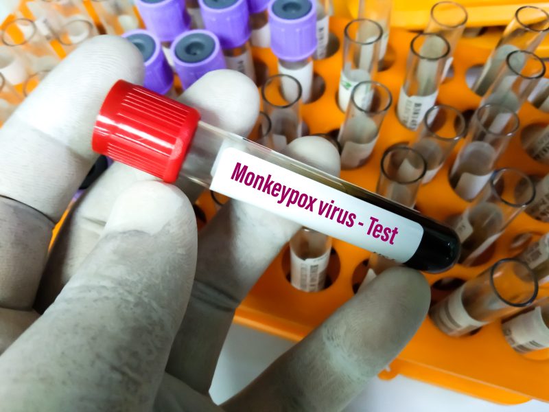 L'EMA envisage le vaccin contre la variole pour combattre la variole du singe