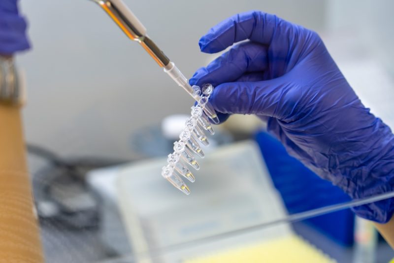 Augmentation des cas de variole du singe : il faut assurer l’approvisionnement en vaccins et en traitements