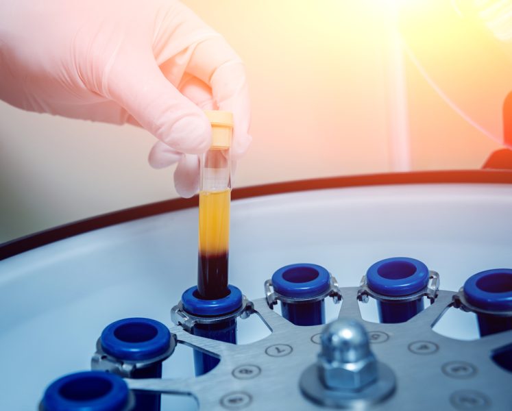 Don de plasma : sous perfusion américaine, la France cherche son indépendance