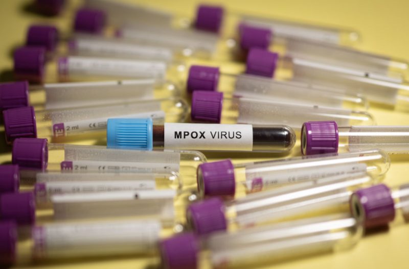 Mpox : un premier cas du nouveau variant identifié en France