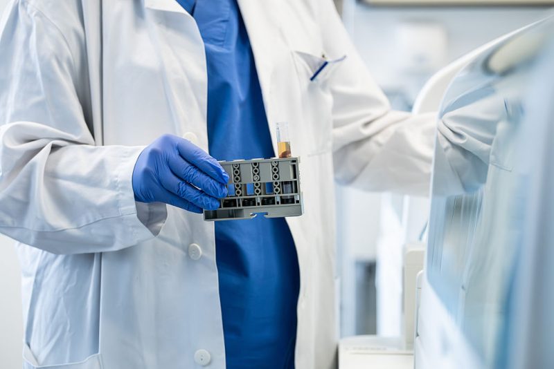 Matériels médicaux : la Chine réplique à l’UE avec des restrictions « réciproques »