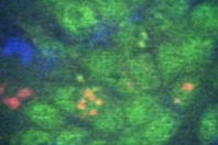 adultstemmcells.jpg