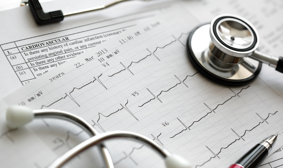 EURACTIV Special Report – Herz-Kreislauf-Gesundheit