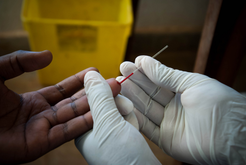 Weltaidstag: Gefährliche Selbstzufriedenheit im Kampf gegen HIV