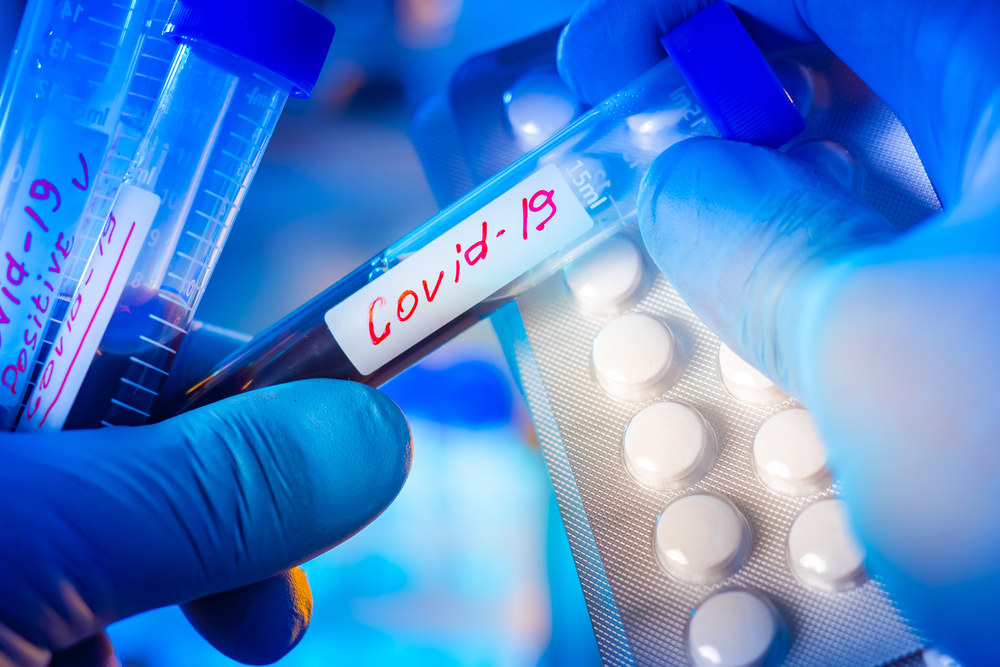 Test,Tubes,With,Covid,Samples.,Concept,-,Drugs,For,Coronavirus.