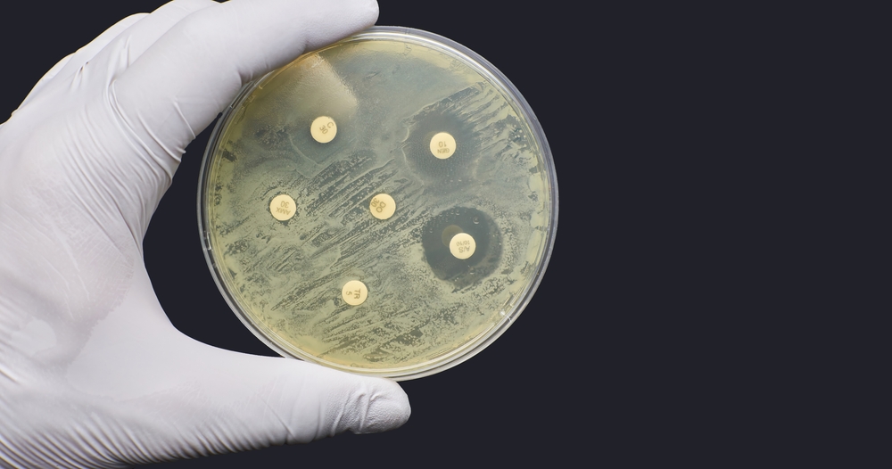 Antimicrobial,Susceptibility,Resistance,Test,By,Diffusion,On,Black,Background