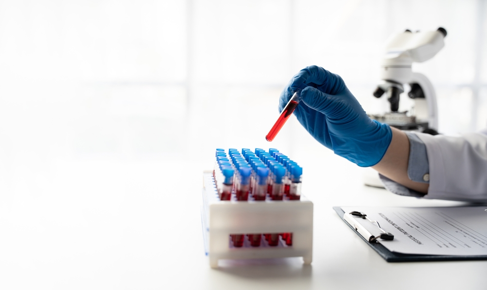 Doctor,Hand,Taking,A,Blood,Sample,Tube,From,A,Rack