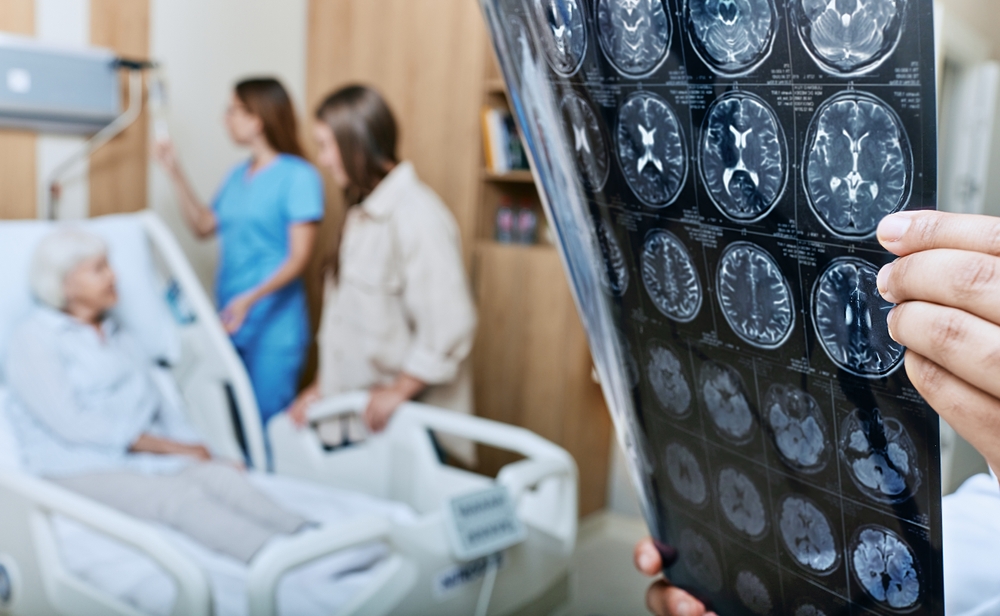 Mri,Of,Head,Of,Elderly,Woman,In,Hands,Of,Doctor
