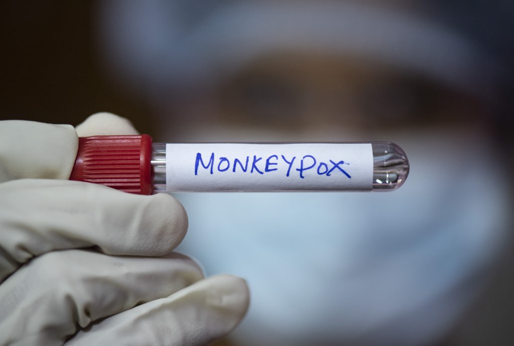 Photo Illustration Of Monkeypox Virus